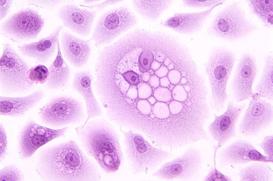 HPV oncoprotein HPV oncoprotein