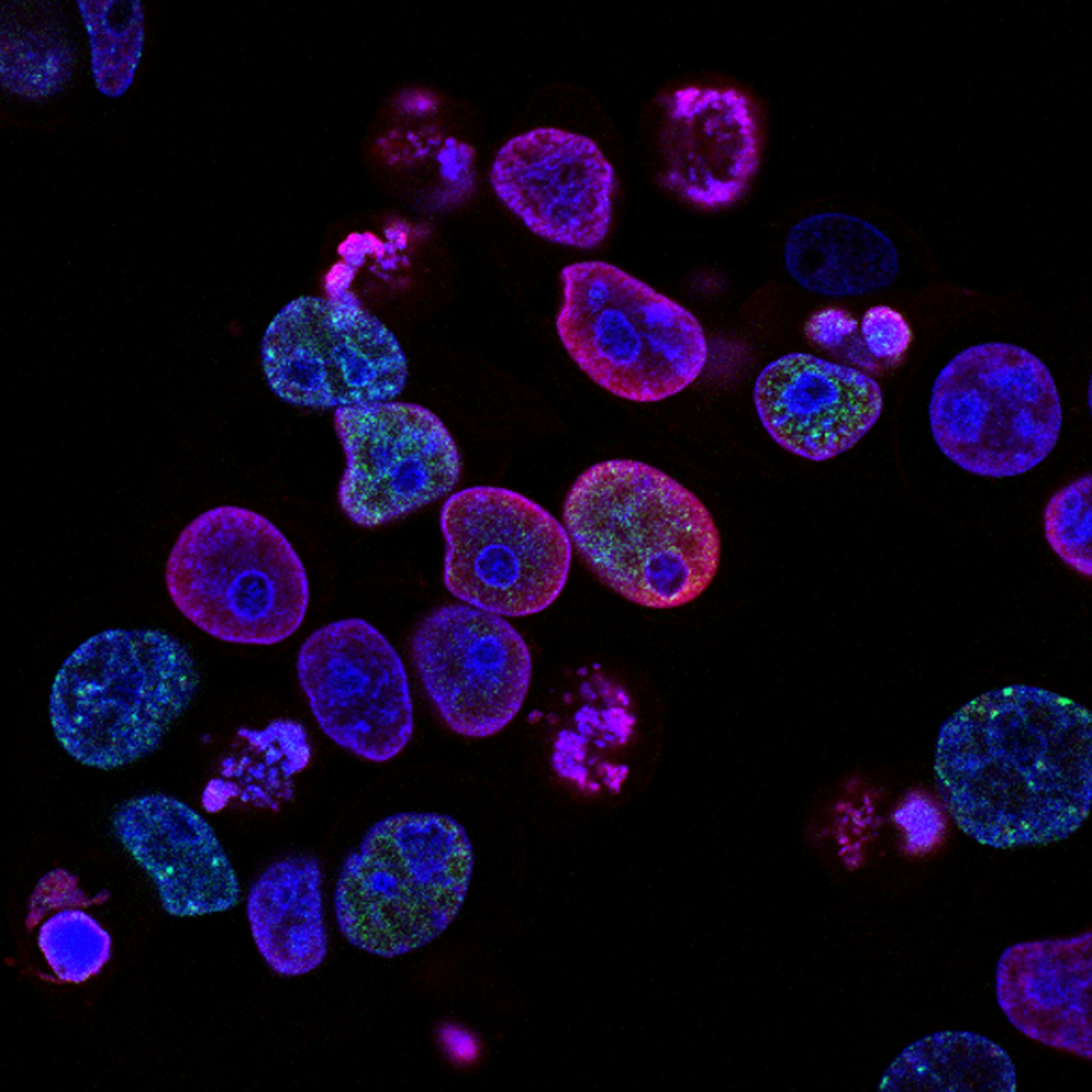 Photo by National Cancer Institute Photo by National Cancer Institute
